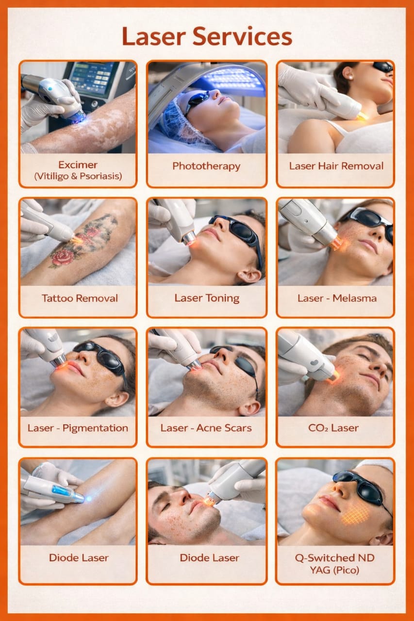 Laser Services